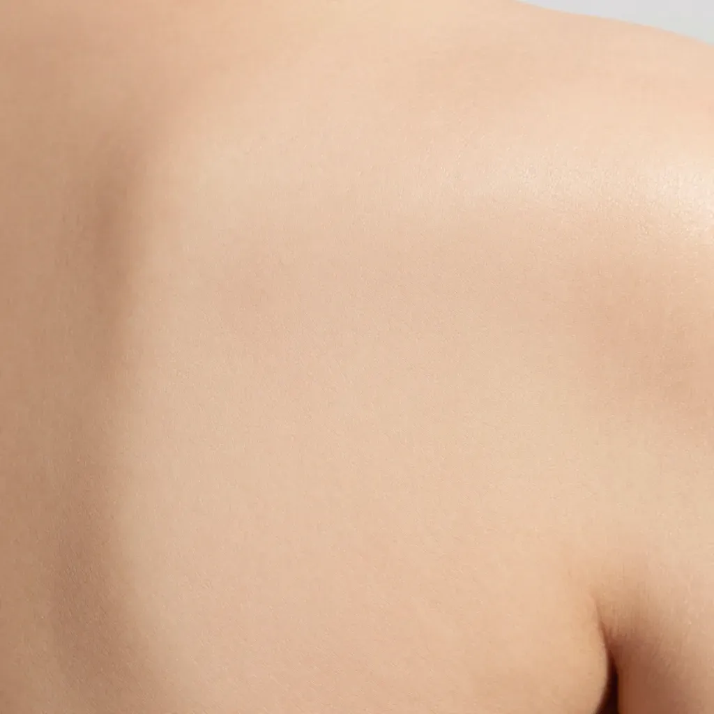 After Removing Ingrown Hair