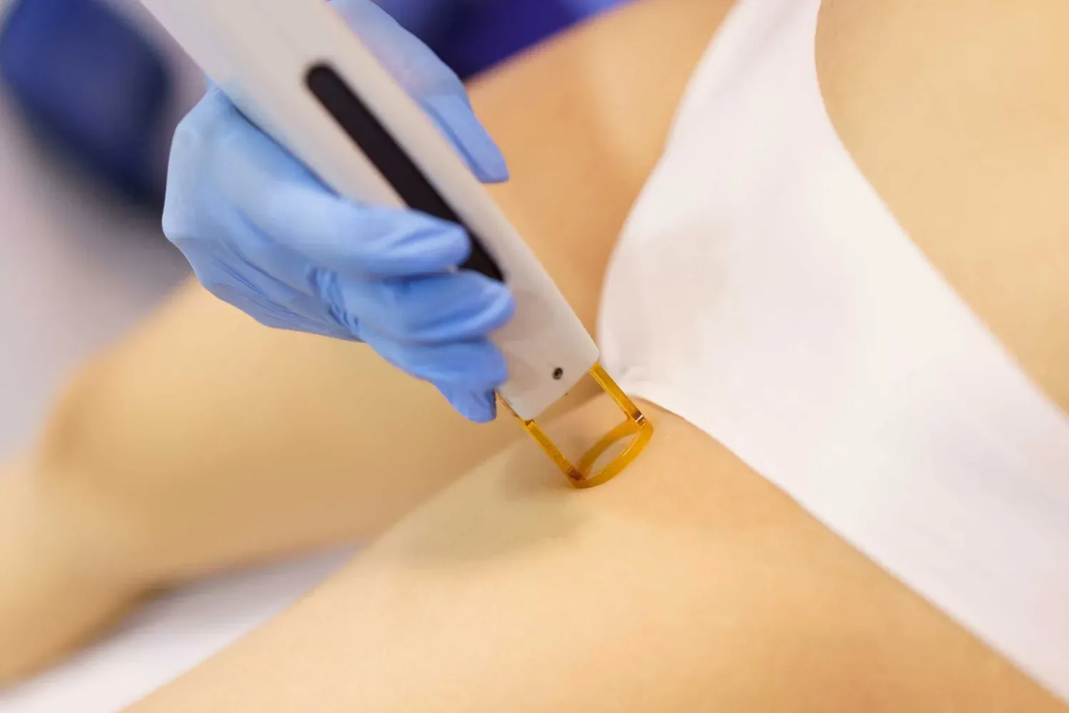 Aftercare: What Comes After Brazilian Laser Hair Removal