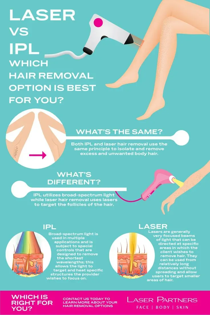 The Essential at home laser hair removal pros and cons