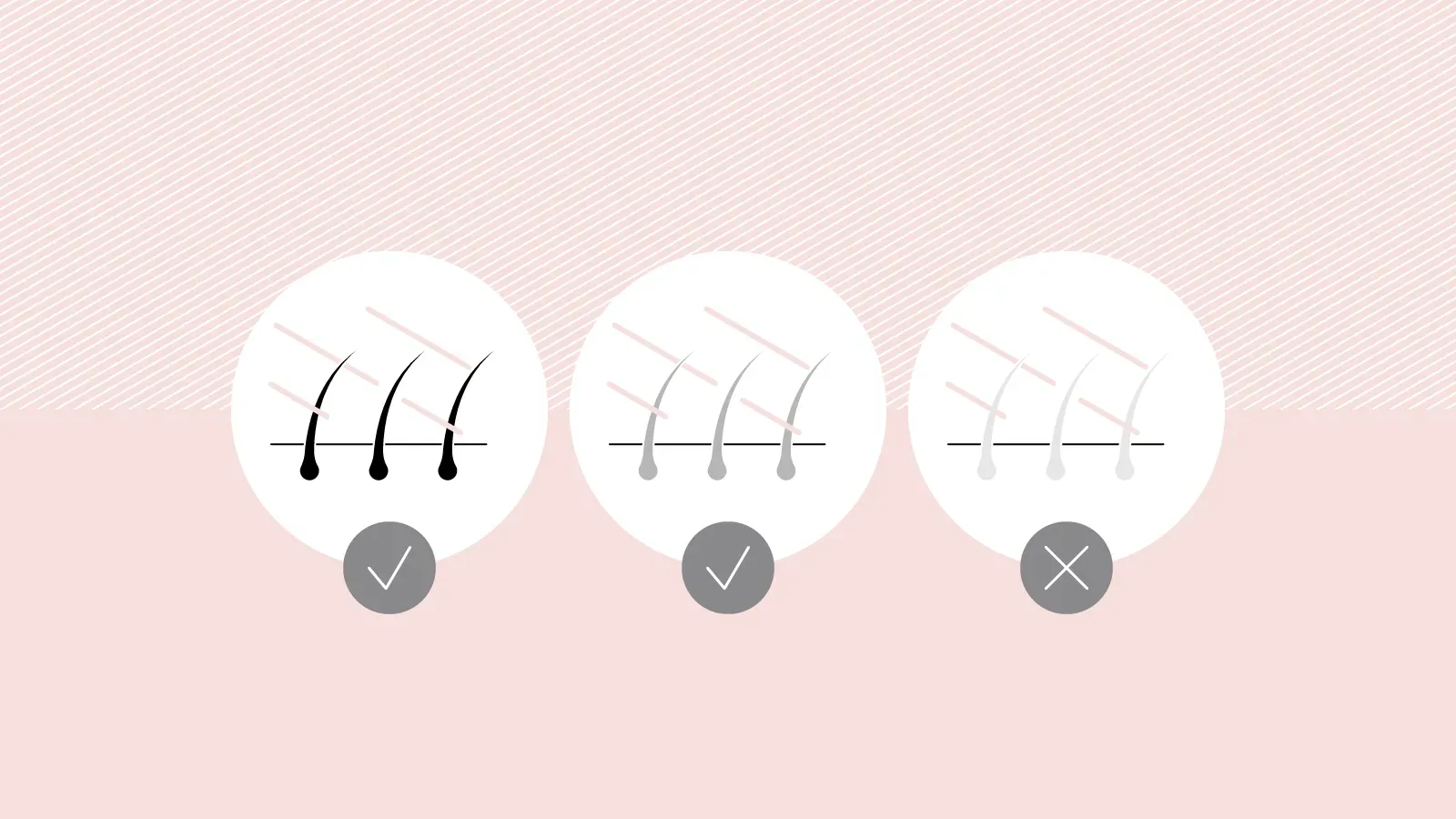 The Ultimate Guide: best hair type for laser removal