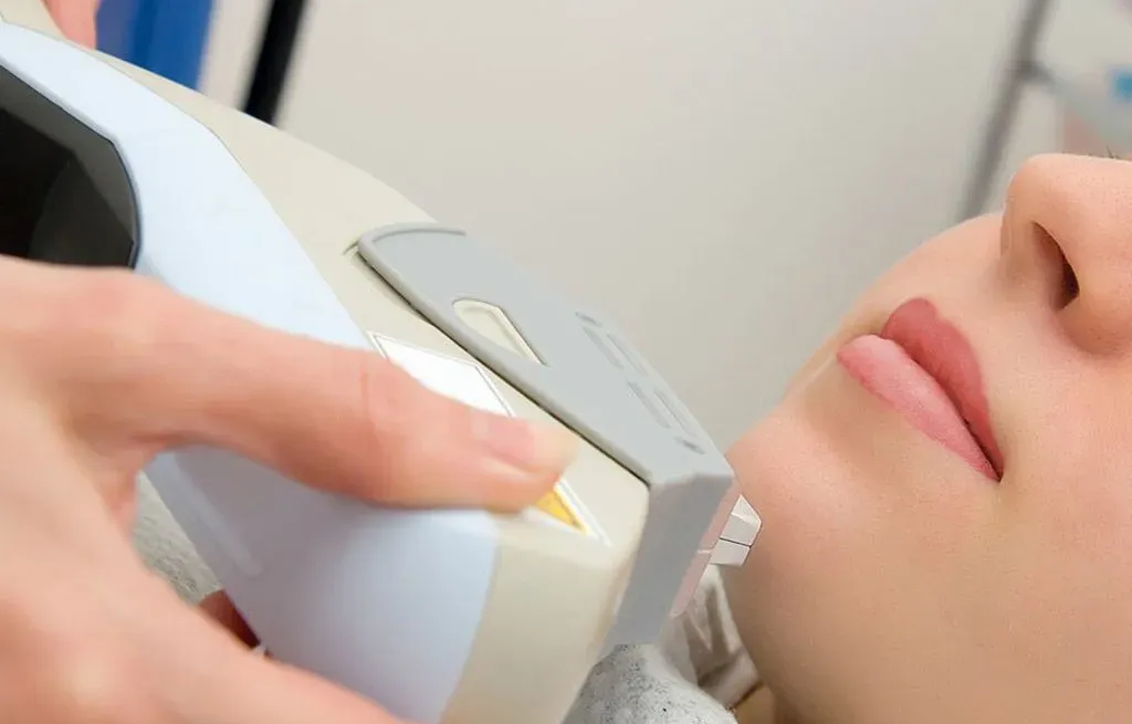 Absolute best laser hair removal San Jose