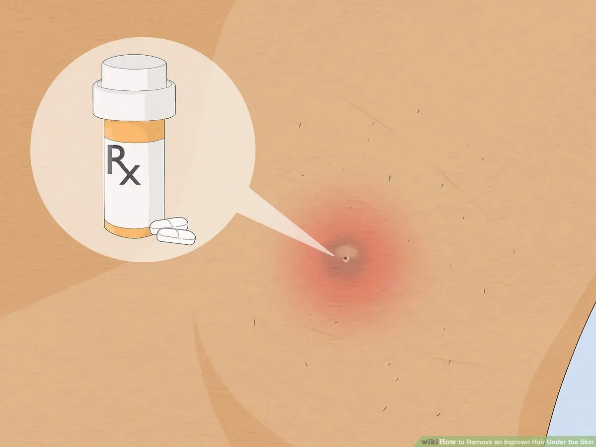 Better Ways to Handle Ingrown Hairs