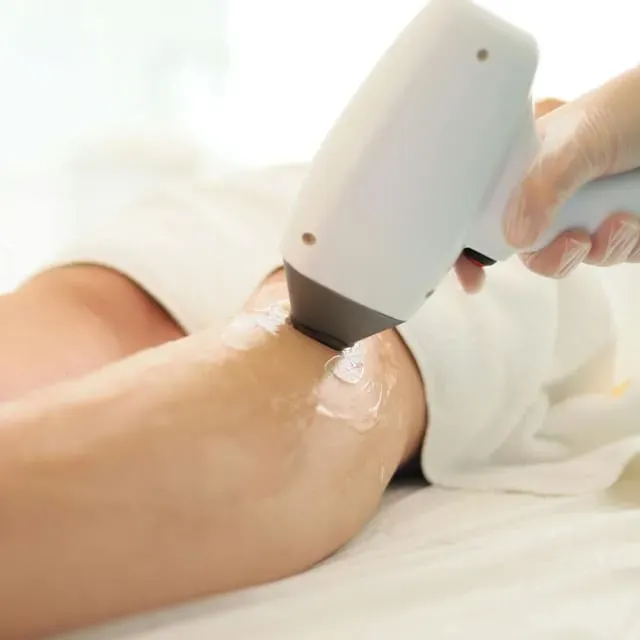 Beyond the Machine: Picking the Right Clinic and Technician for Laser Hair Removal in London