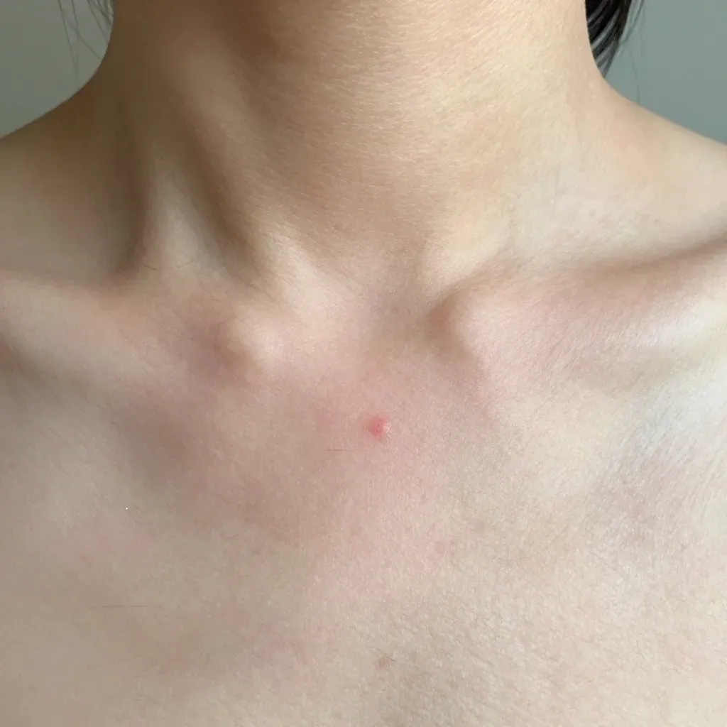 Can Waxing Remove Ingrown Hairs? What You Need to Know