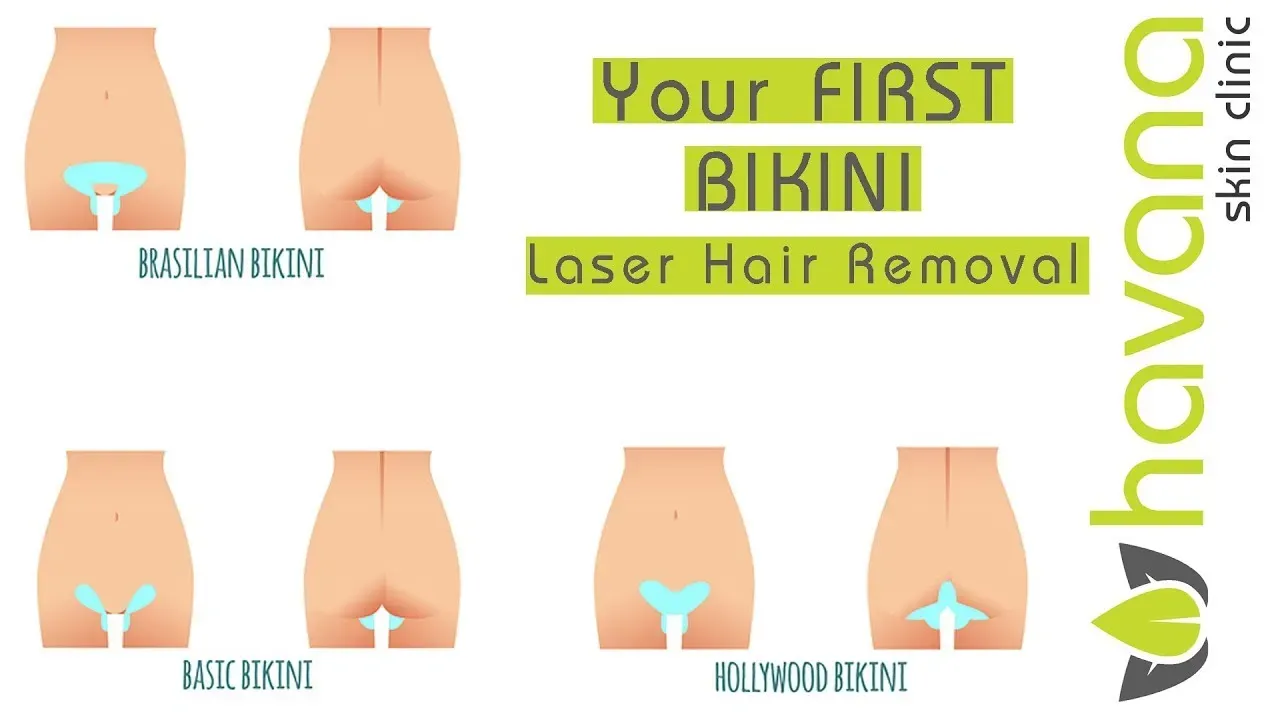 Key Steps: How to Prep for Brazilian Laser Hair Removal Sessions