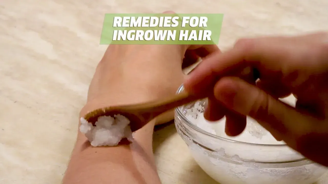 LongTerm Solutions to Avoid Ingrown Hairs