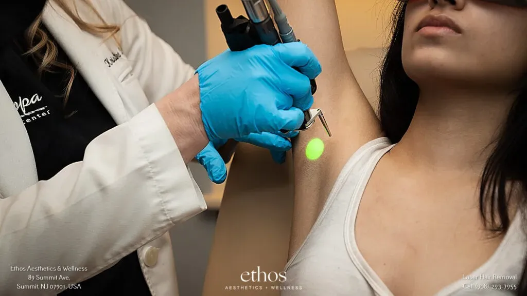 Maintaining Your Smooth: Aftercare for Best Underarm Laser Hair Removal