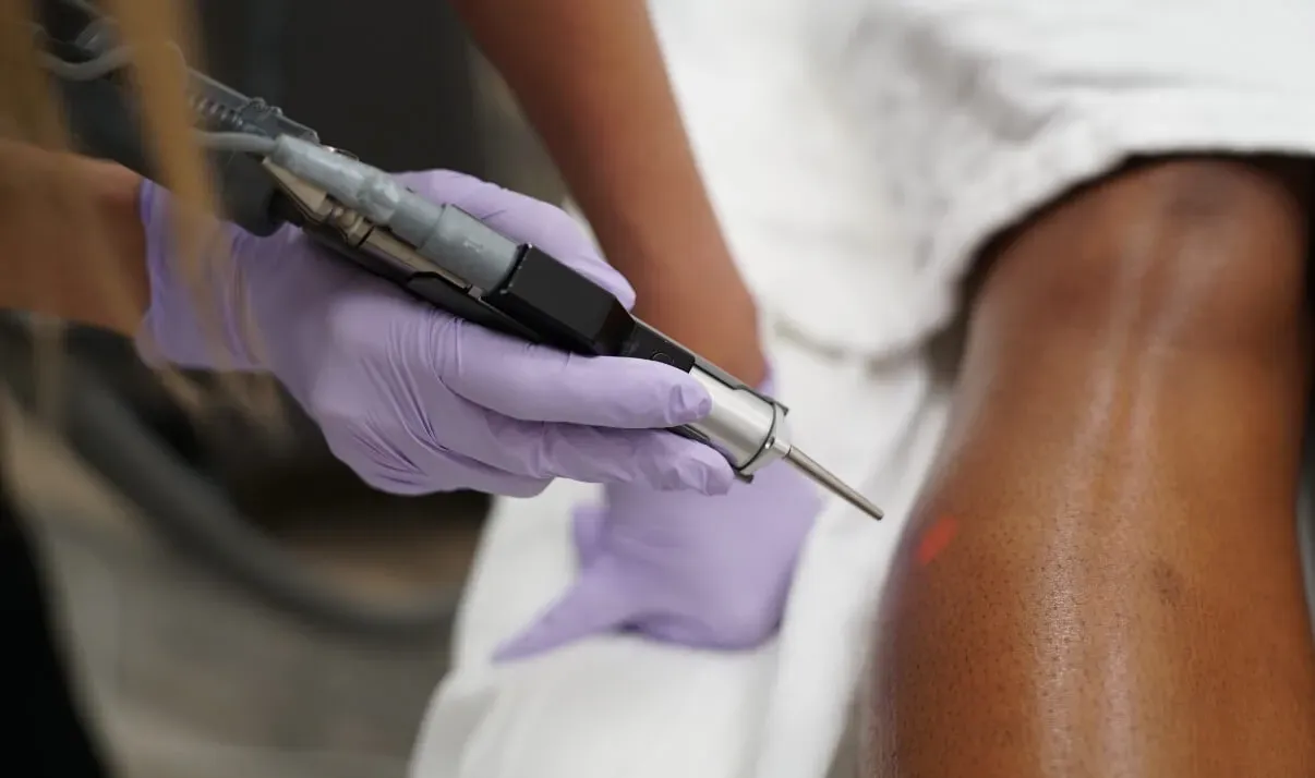 Making the Decision: Is Brazilian Laser Hair Removal at LaserAway Right for Your Budget?