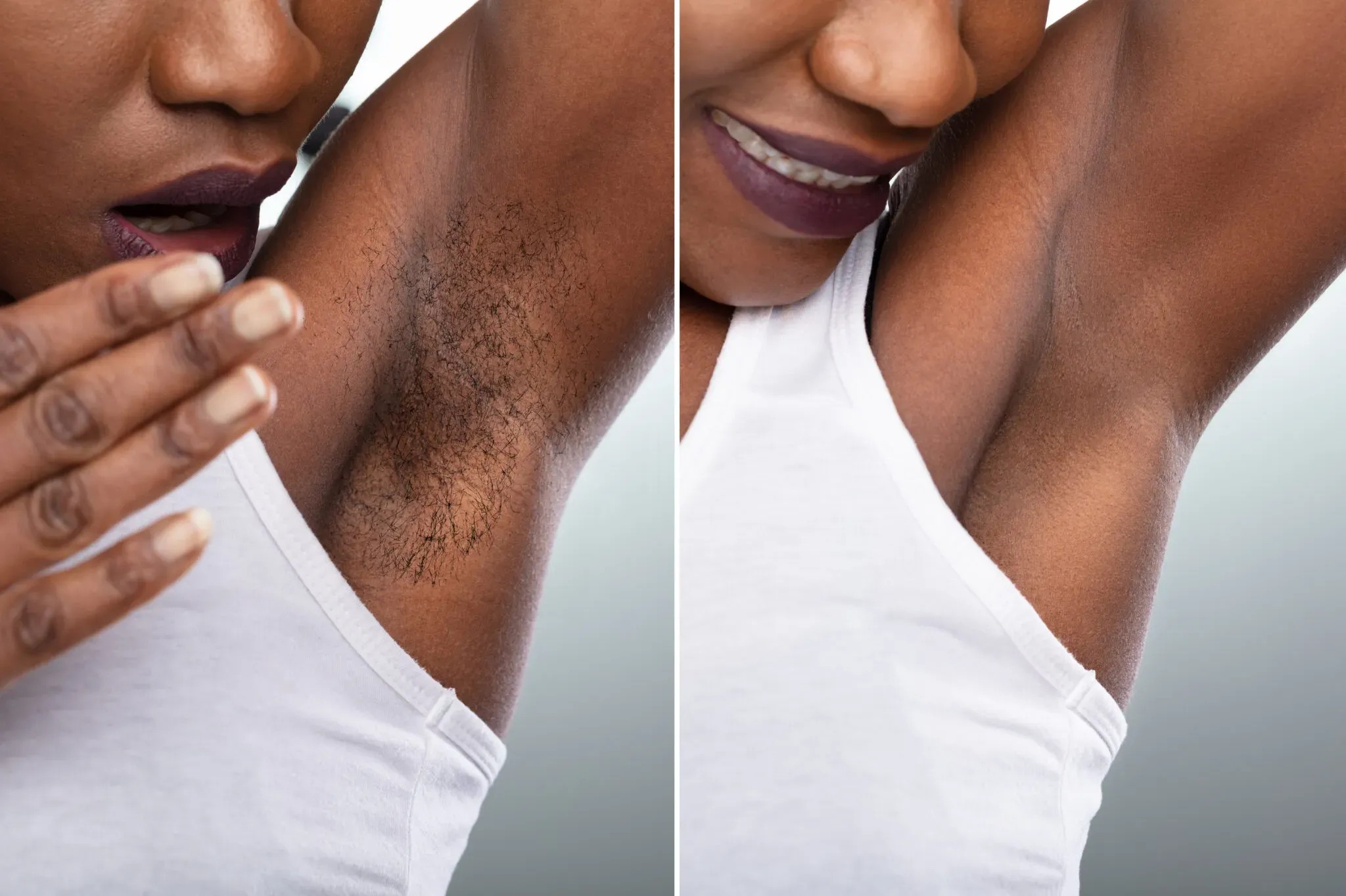 Potential Risks and Results of Brazilian Laser Hair Removal on Dark Skin
