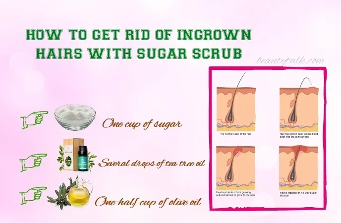 Proven Methods for Fast Ingrown Hair Removal at Home