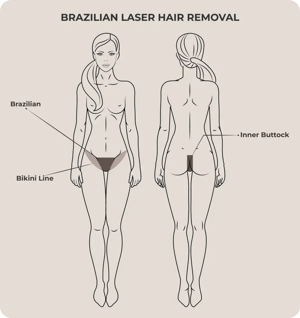 So, Is Brazilian Laser Hair Removal Considered a Large Area?