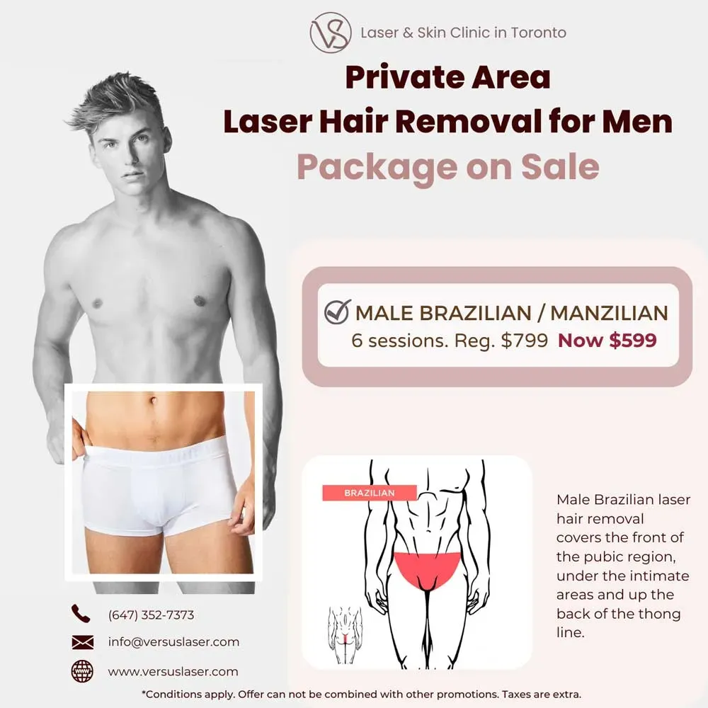 Understanding Brazilian Laser Hair Removal for Men