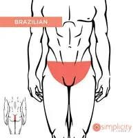 Understanding Brazilian Laser Hair Removal for Men