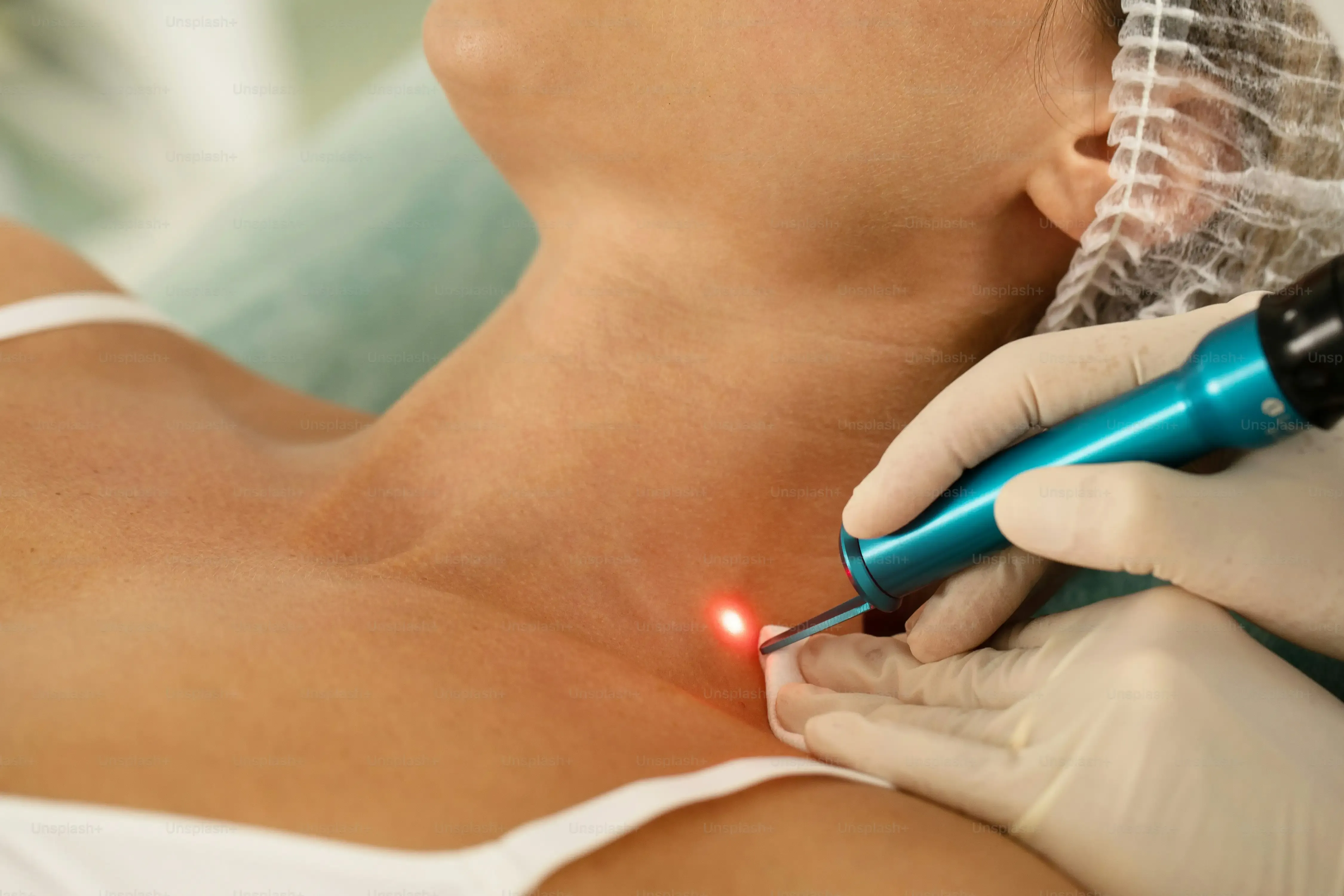 Using Your AtHome Diode Laser Hair Removal Device Safely