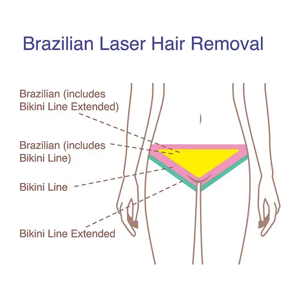 Get The Truth: what area is brazilian laser hair removal