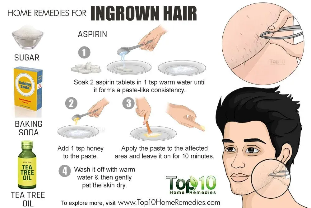 What Causes Ingrown Beard Hairs and How to Spot Them