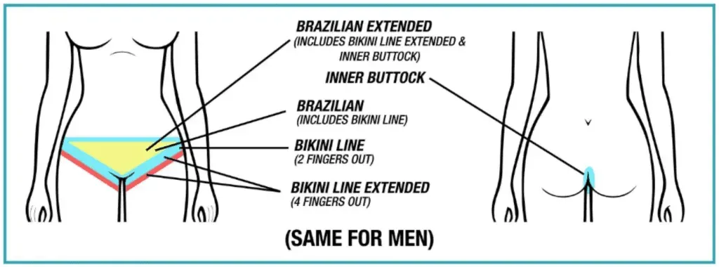 What Exactly is Brazilian Laser Hair Removal?