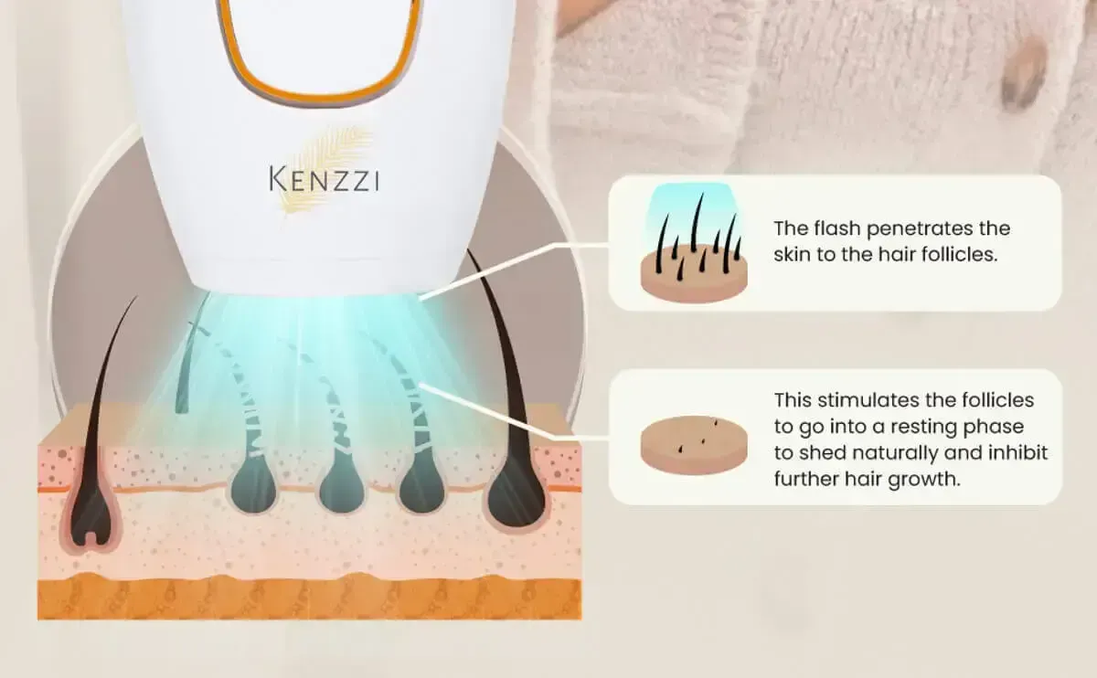 Essential: what is the best at home laser hair removal