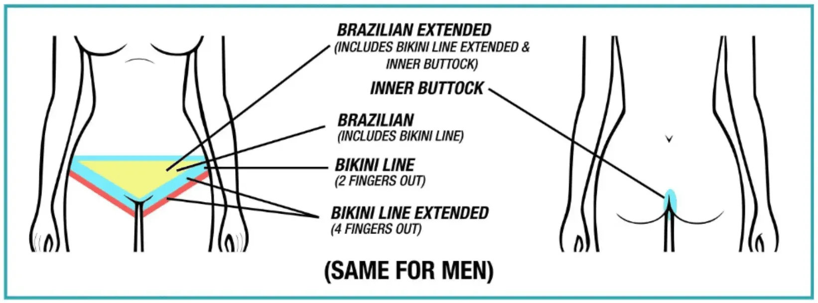 What to Expect After Your Brazilian Laser Sessions