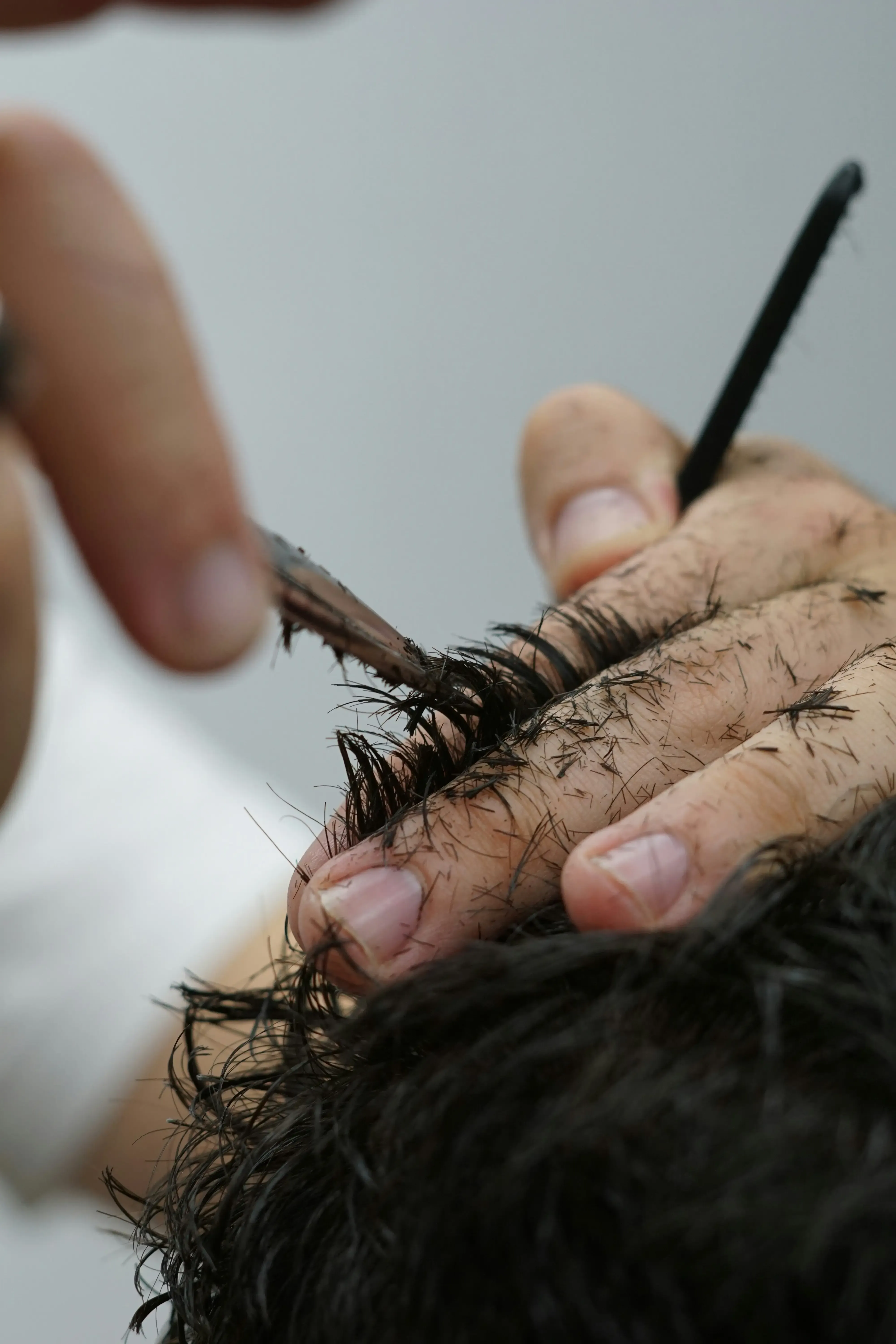 What to Expect During and After Your Brazilian Laser Hair Removal Session