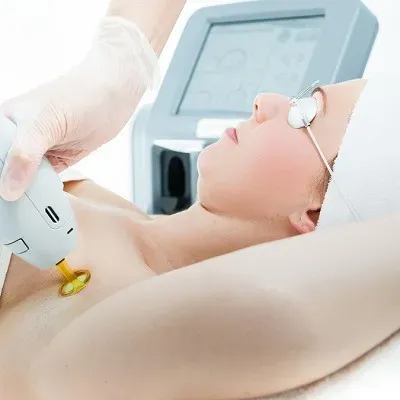 Why Choose Brazilian Laser Hair Removal in Dubai?