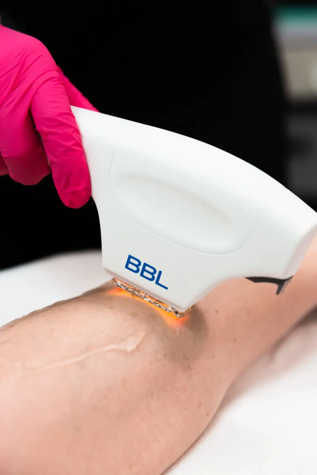 Why Finding the Best Place for Laser Hair Removal Near Me Matters